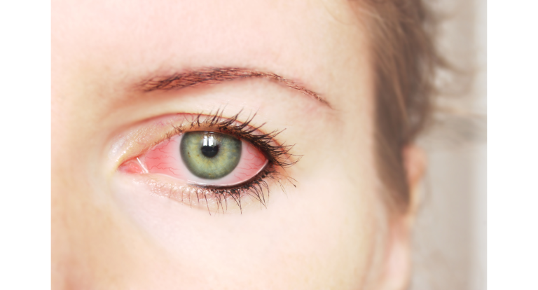 Treat eye infection in Cedar Park, TX Signature Eye Care